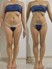 【人気No1！全身スピード痩身90分】人気マシン×強力ハンドで脂肪燃焼&撃退