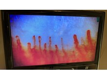 リプレサ バイ エステマニア(Ripresa)/毛細血管