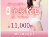 【女性期間限定】全身美容脱毛DX(顔・VIO込み）￥11000　都度払いで安心♪