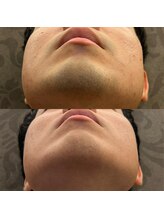 フェリーバ(FELIVA)/清潔感UP