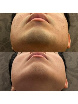 フェリーバ(FELIVA)/清潔感UP