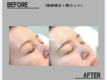 ネムリビト/微アーチ眉