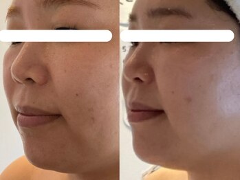 ジョーヌ(JAUNE)/毛穴レスな褒められ肌へ