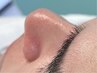 【メンズ】皮脂急増対策◎毛穴徹底洗浄!¥12,000→ ¥9.000