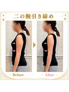 ボディキュア ブライダル美容整体 大阪梅田の写真/【自分史上最高に美しい自分へ♪】美しく健康的な身体を手に入れたい!それ、ボディキュアにお任せ下さい◎