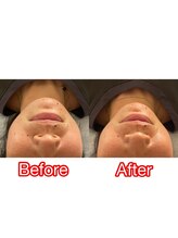 美人バスト 辻堂店/フェイスラインがスッキリ！！