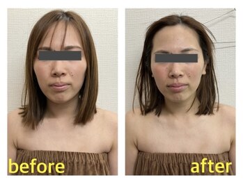 ザ ワン(THE ONE)/美zen筋骨小顔 食いしばり/エラ