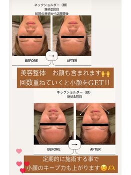 ルアナ 北谷店/小顔マッサージ &nbsp;《沖縄/北谷》