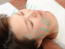 高見鍼灸院 接骨院/美容鍼