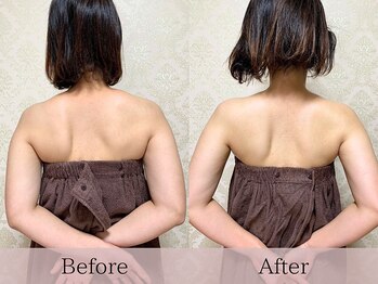 フローラ(FLORA)/天使の羽美ボディリンパ