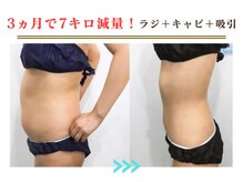エスプラ 五反田店