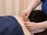 【鍼灸肩コリ・腰痛特化SPコース◎】鍼灸＋全身整体　60分7000円→