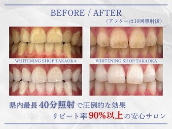 ホワイトニングショップ 高岡店
