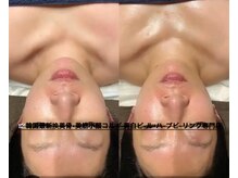 アロマビューティーサロン ジェイハウス(J)/