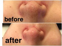 ベベ もりの里店(Be'be')