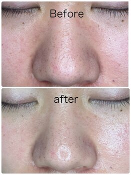 ルミネル 名古屋新栄(Luminelle)/毛穴の汚れすっきりトーンアップ