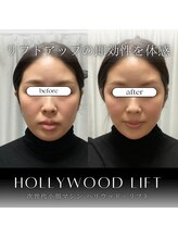 ブリリオプラス 四条烏丸店(Brillio plus)/ハリウッドリフト