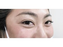 ルピナス 武蔵小金井店(Lupinus)/ボリュームラッシュ500本