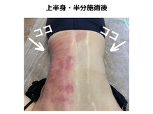 ルプリュシュ ルフレ(Le plus reflet)/激セル痩身