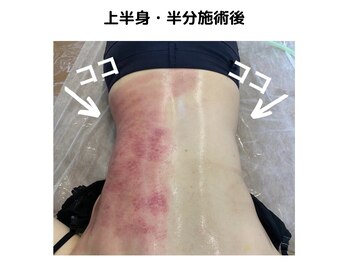 ルプリュシュ ルフレ(Le plus reflet)/激セル痩身