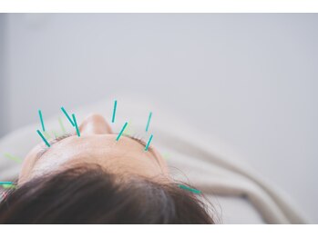 メディカルサロン MARUYAMA/［健康美容鍼］‐FACE‐