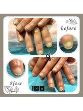 ミシェル(Michelle)/育爪ハンドネイルケア