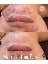 ビジュープラス ひたち野うしく店(Bijou+)/