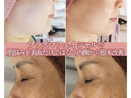 キキ(KiKi)の写真