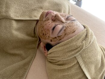 ティセ(TisseR)の写真/【肌質改善】当店人気ハーブピーリング！ニキビ/毛穴/シミ/小ジワを徹底的にケア♪施術後はツルスベ肌に◎