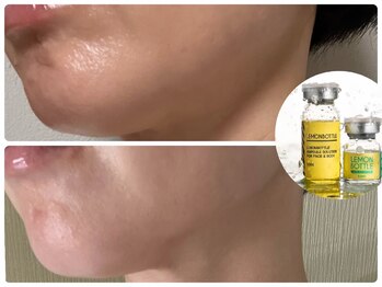 トータルビューティサロン リボーテ(Re:Beaute)