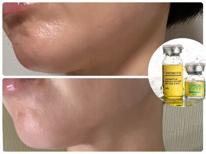 トータルビューティサロン リボーテ(Re:Beaute)の写真