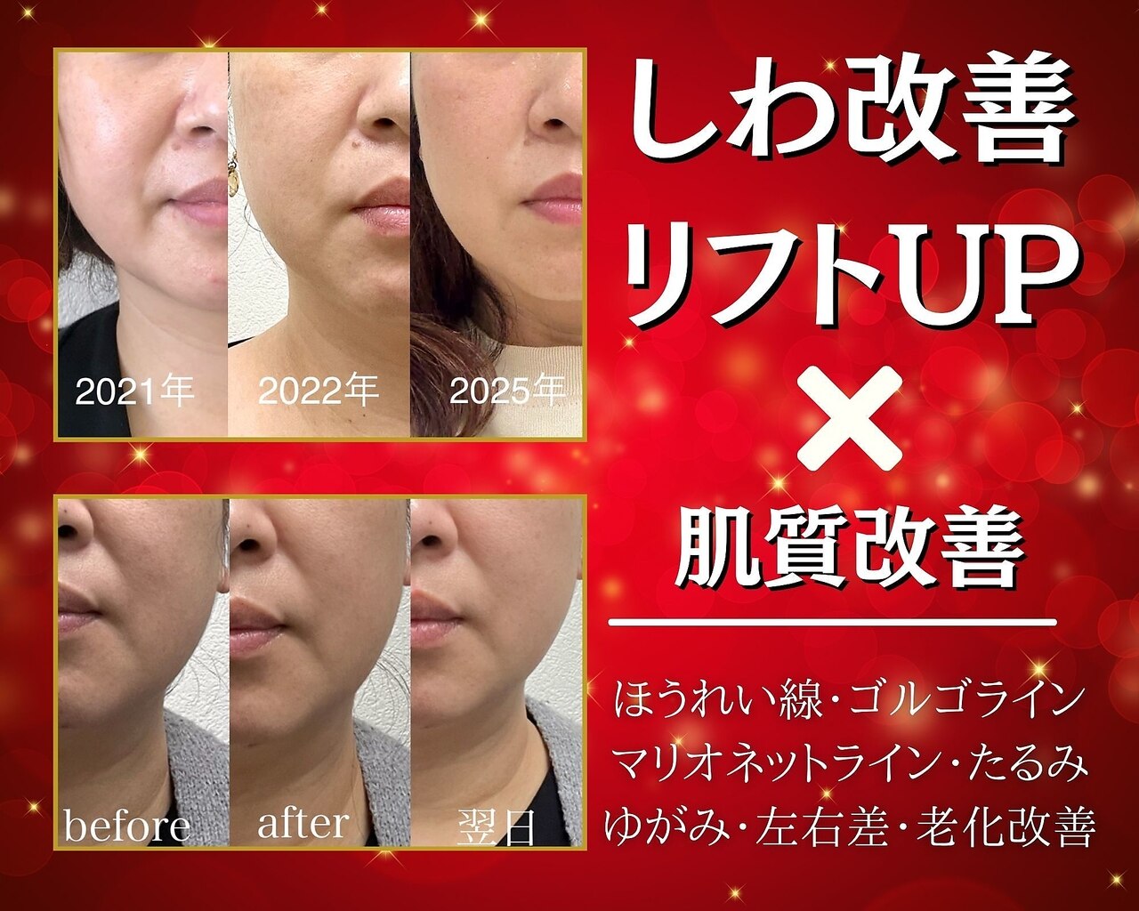 エイジングケアサロンシー(aging care salon cee)｜ホットペッパー