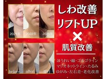 エイジングケアサロンシー(aging care salon cee)