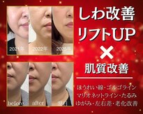 エイジングケアサロンシー(aging care salon cee)