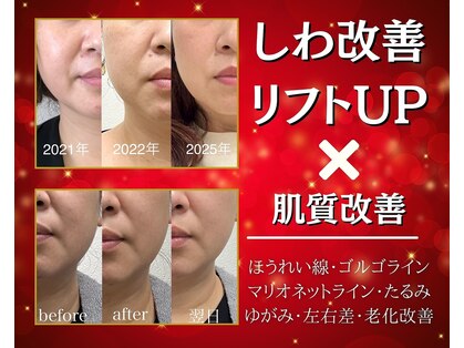 エイジングケアサロンシー(aging care salon cee)の写真
