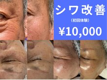 フェリス(FELIZ)の雰囲気（シワにアプローチ！ハリツヤ求めるなら純粋レチノールピール）