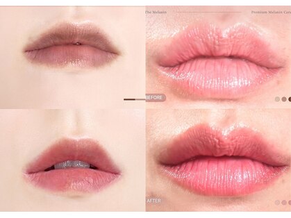 ドクターメラニン ラボ トーキョー 渋谷(Dr. Melanin Labo TOKYO)の写真