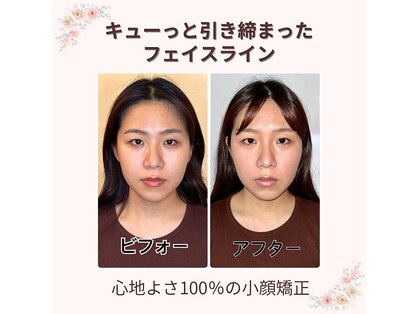 プレシャス(PRECIOUS)の写真