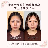 プレシャス(PRECIOUS)