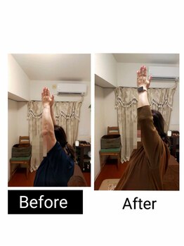 アース エンジェル整体院/ビフォアフ 肩こり ストレッチ