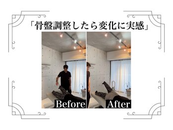 鍼灸整体院ユー(鍼灸整体院You...)/before/after