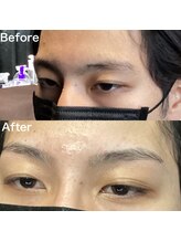 眉毛ハウス 吉祥寺店(眉毛HOUSE)/お客様の施術例(吉祥寺/東京)