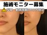 ¥14800から65％OFF◆7/29,30,31限定モニター募集◆最新リフトアップ『Lifit』