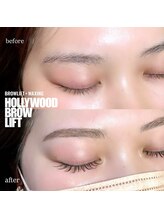 ナブラ デュオ(NABLA Duo)/ハリウッドブロウリフト