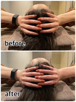 スリーピー 福島店(SLEEPY)/【before after】脳内デトックス