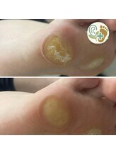 チェンジ(CHANGE)/タコケアサービス