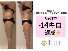 ブレス 天童店(BLESS)の雰囲気（結果に自信!【東北初!全国エステグランプリ準優勝獲得サロン】）