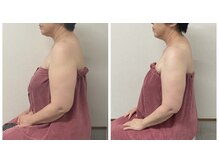 ブリランテ(Brillante)/