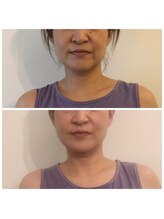 ミチカケ トリムリターン那覇市店/フェイスラインに変化！