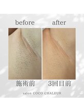 ココ シャルール(salon COCO CHALEUR)/Before　After